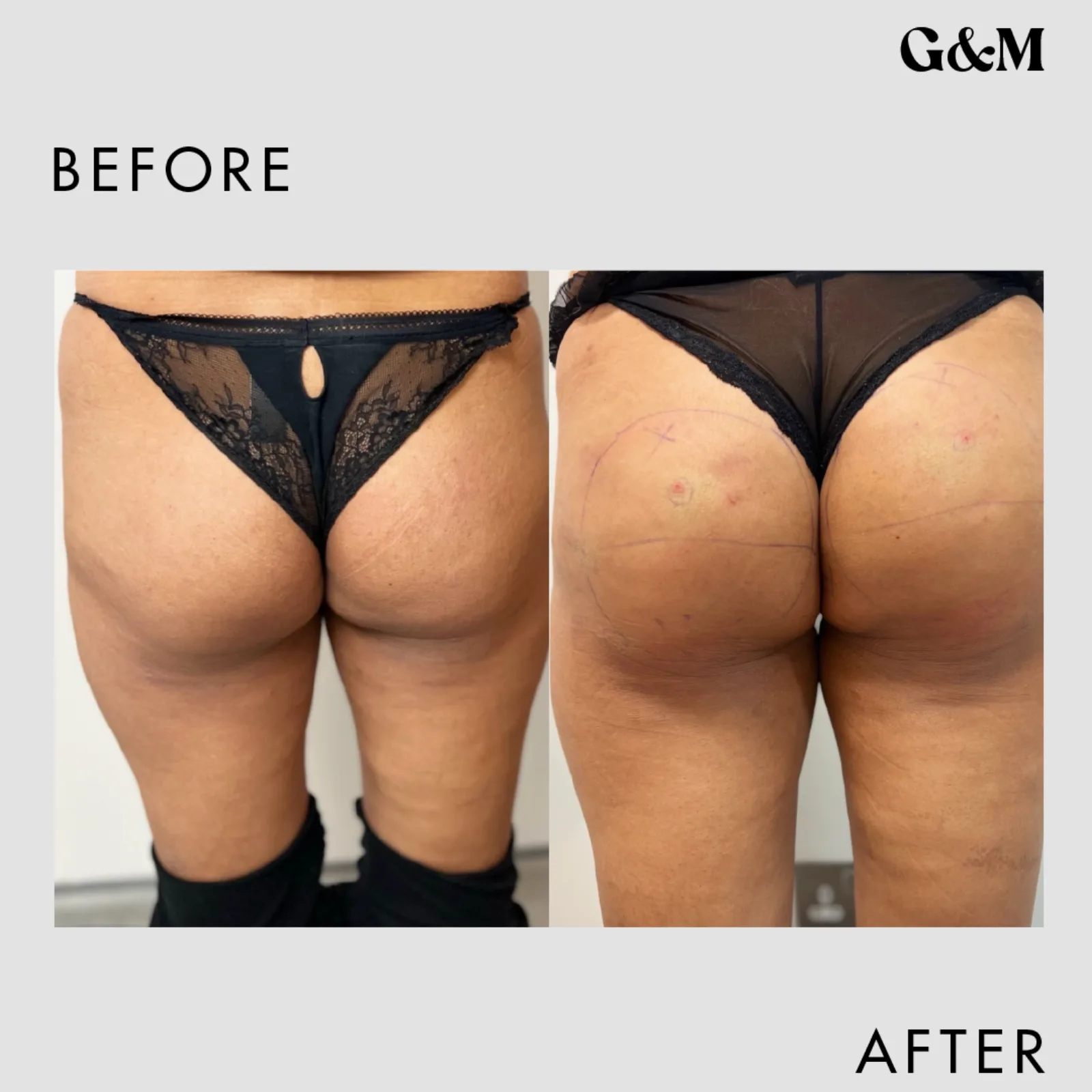Before and after — Sculpt — 100ml