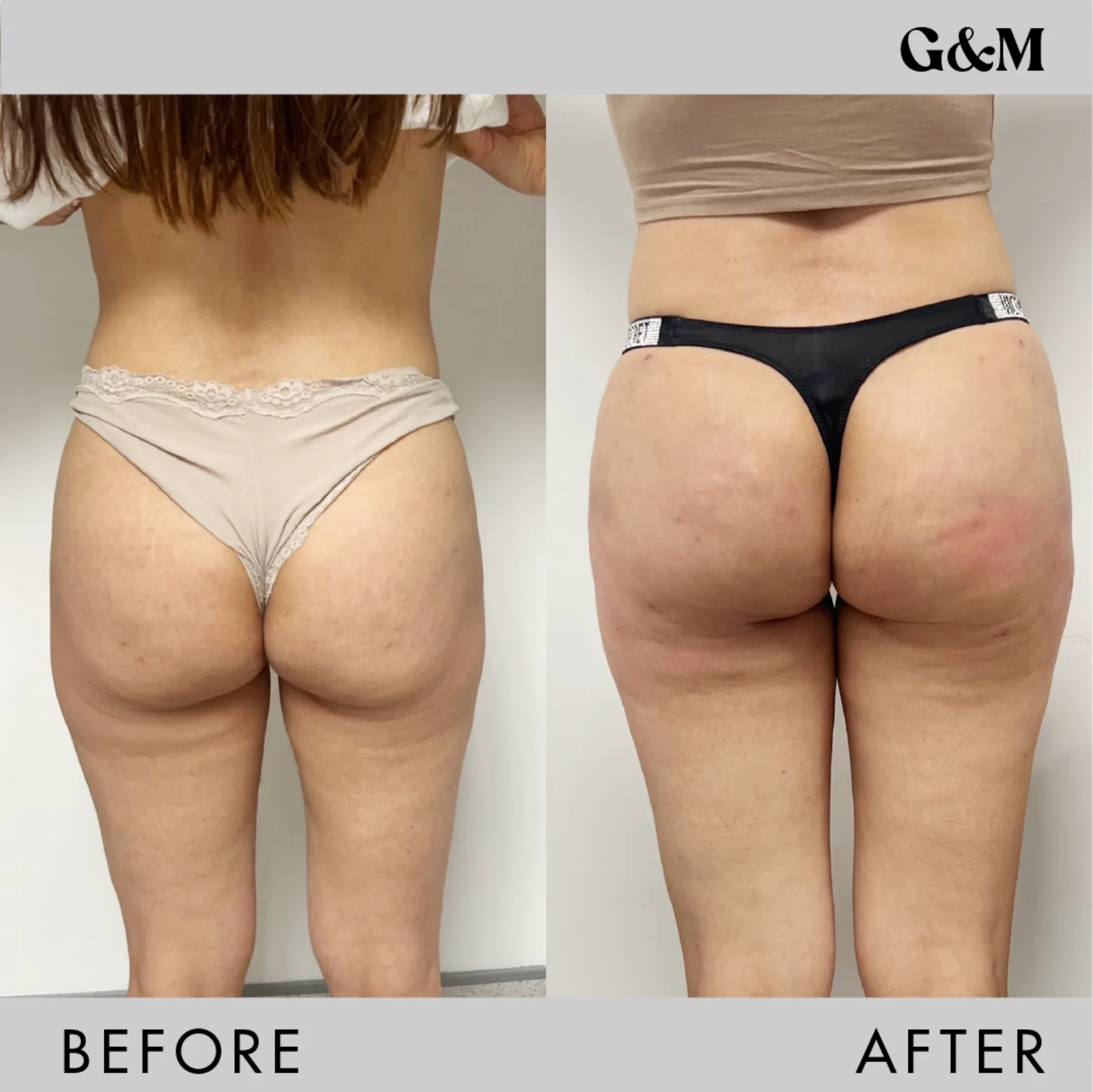 Before and after — Sculpt — 100ml