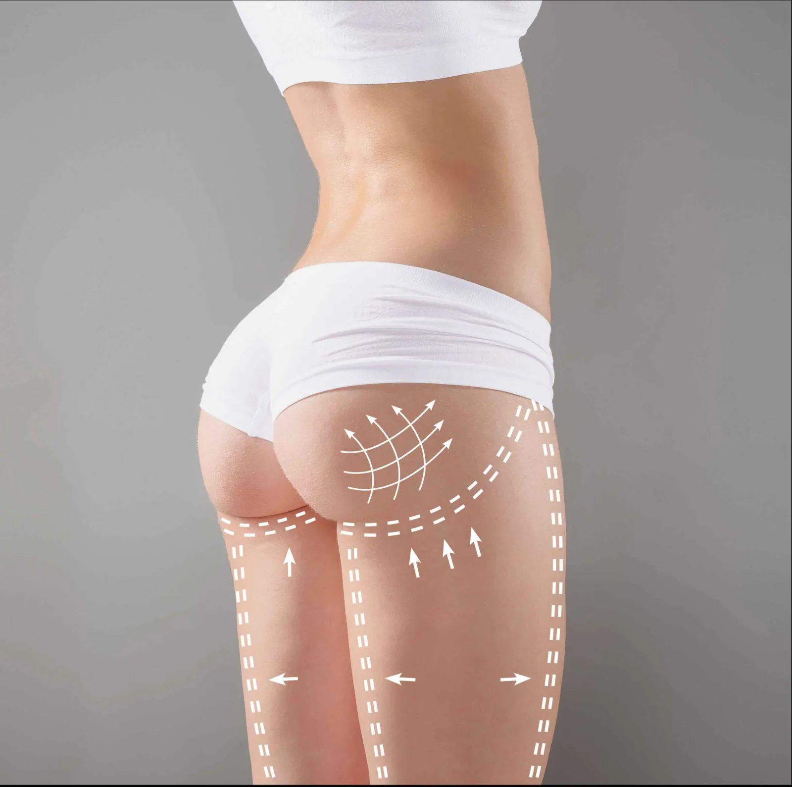 Non-Surgical BBL (Bum Filler)